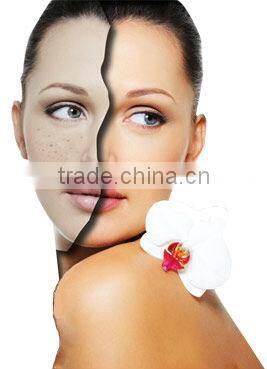 Hot!! Newest and best effective Beauty salon equiment for skin rejuvenation