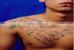 1064nm&532nm Q-switch Nd:YAG laser machine