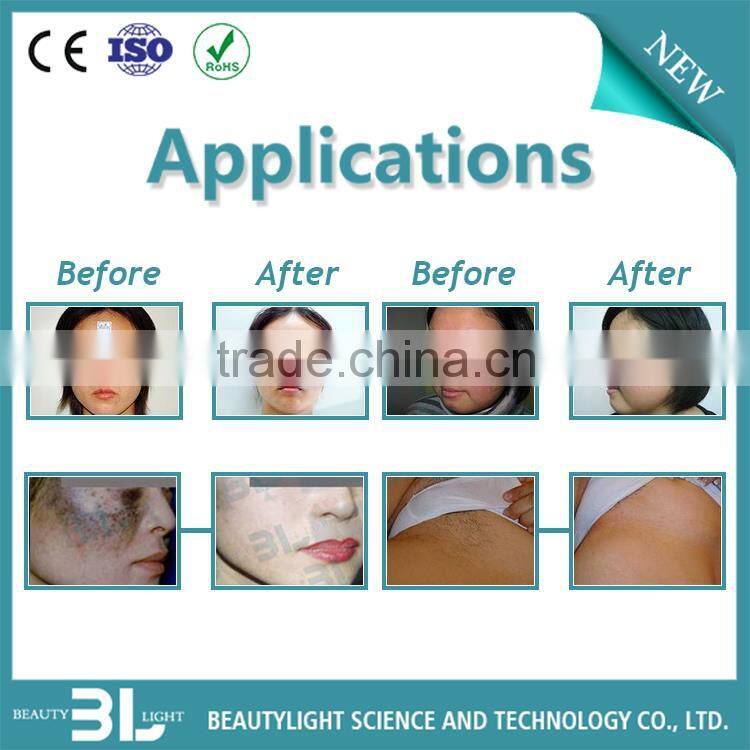 Hotest multifunctional E-light beauty machine Model Diana -C with 3 in one System