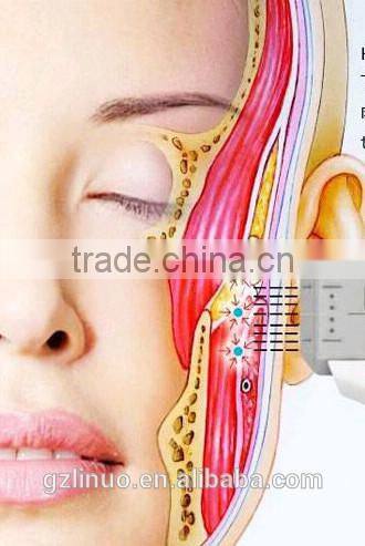 NEW HOT! FU4.5-2S Best Effect HIFU face lift