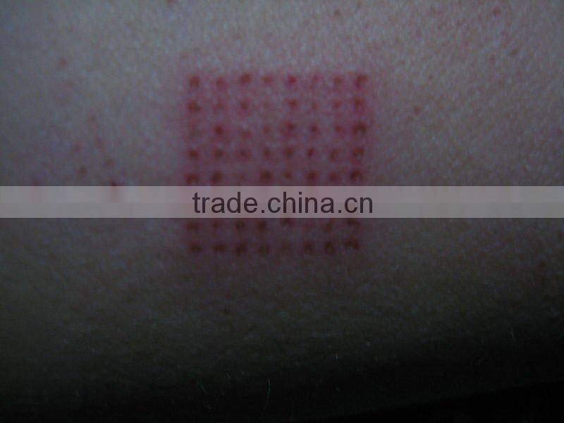 facial rejuvenation beauty equipment