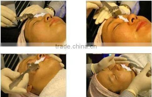 L005--Best dermatologist 540 titanium microneedle roller