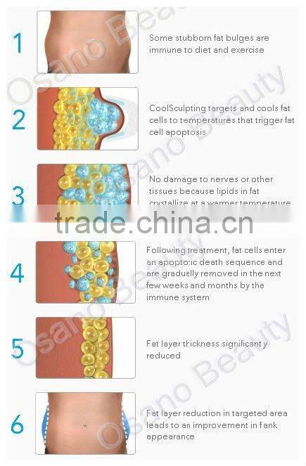 Hot selling products !Newest update and health cryotherapy anticellulite slimming machine portable fat freezer