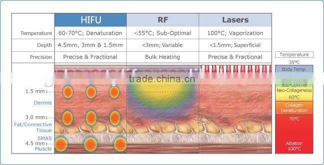 New design ultrasound hifu skin care machine guangzhou