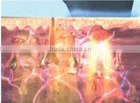 Hot Promotion!!!!!! Spa shr ipl hair removal machine shr hairy removal opt