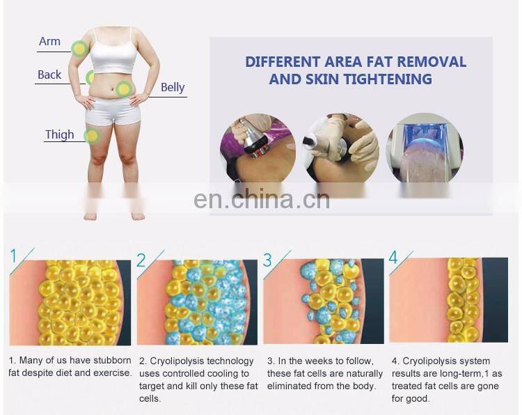 Hot sale cryo weight loss machine cyrolipolysis slimming machine/cryolipo slimming machine