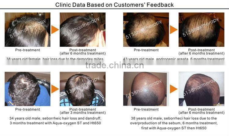 Hair Regrowth Laser Therapy LLLT