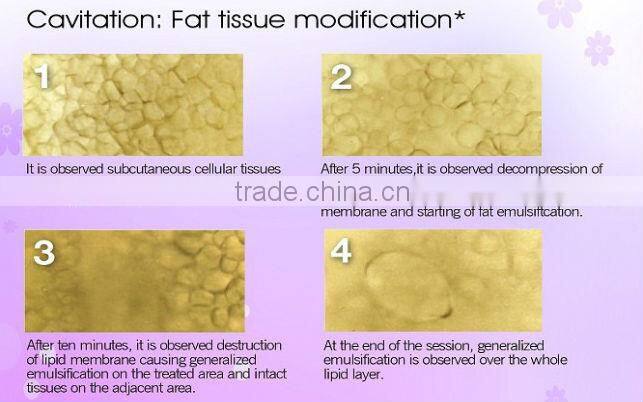 T&B Luna V Plus ultrasound cavitation weight loss machine CE