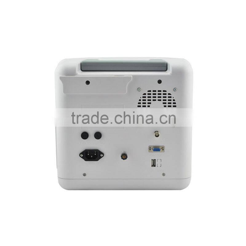 2016 Large Screen Cheapest Portable Ultrasounic Diagnosis Scanner Machine System with Convex/ Linear Transducer and Sony Printer