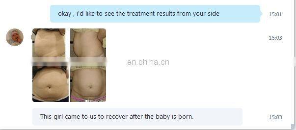 Velashape body shaping equipment vaccum radiofrequence velashape 2 machine for sale