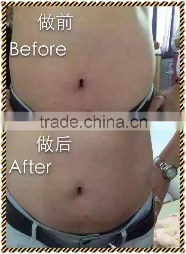 distributor wanted hot selling beauty equipment body shaping hifu