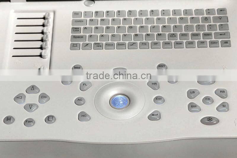 15-inch Laptop Ultrasound Scanner with Multi-frequency probes