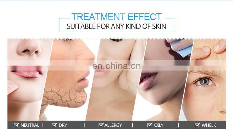 Beauty salon use ELIGHT IPL 808nm Diode laser ND YAG LASER hair removal machine for women