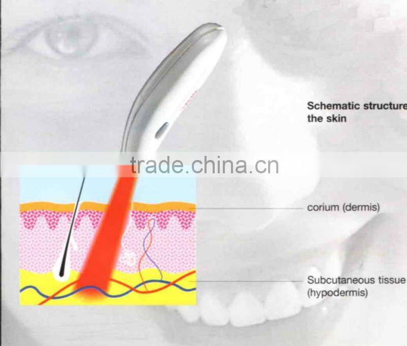 soft laser ance treatment skin care face beauty machine home use 2015