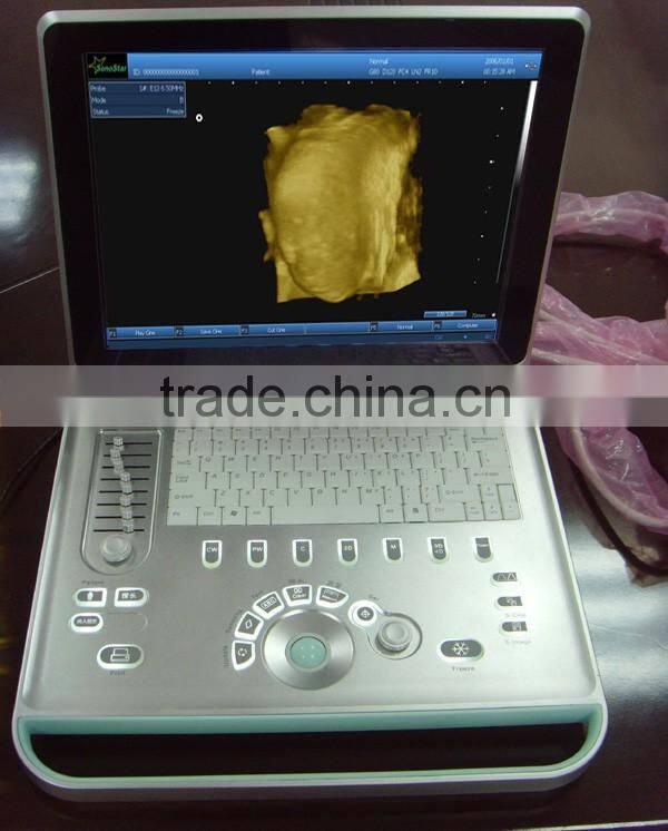 Sonostar hospital veterinary equipment B model ultrasound machine for sale V9