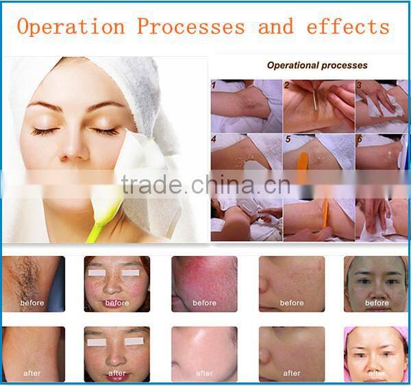 2016 hot most effective fast hair removal machien OPT SHR machine