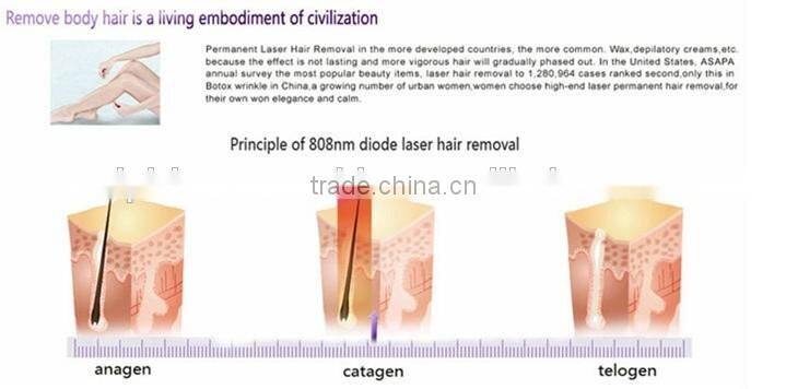 Manufacturers Looking For Distributors / 2015 Hot Vertical 808nm Diode Laser Hair Removal Beauty Salon Equipment