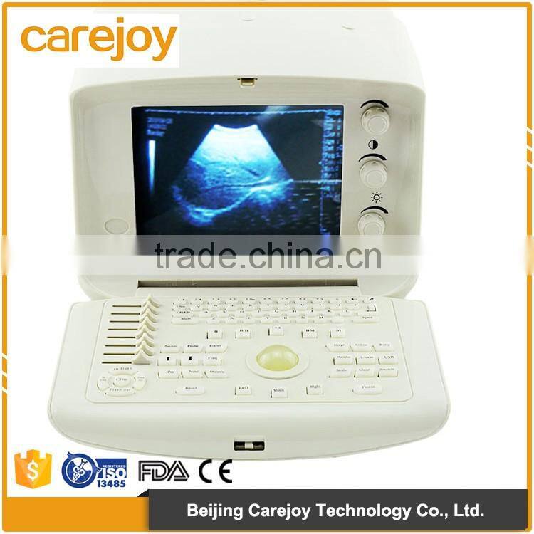 portable ultrasound scanner ultrasound machine with low price