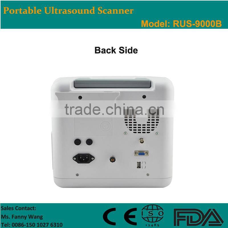 Factory price!CE approved Notebook B-Mode Ultrasound Scanner with 7.5Mhz multi-frequency linear probe RUS-9000B