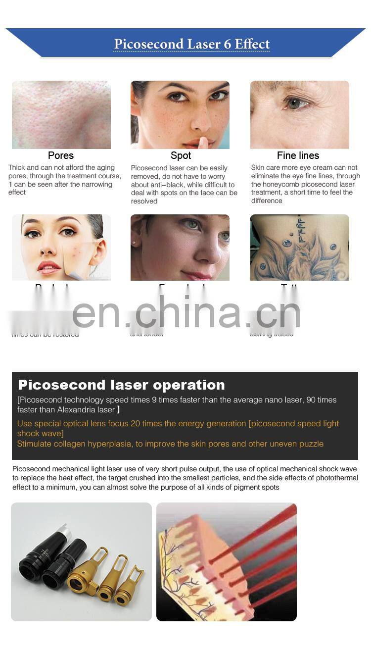 ND YAG Pico second Good Way Laser Pigment Remover Eyebrow Tattoo Removal Machine