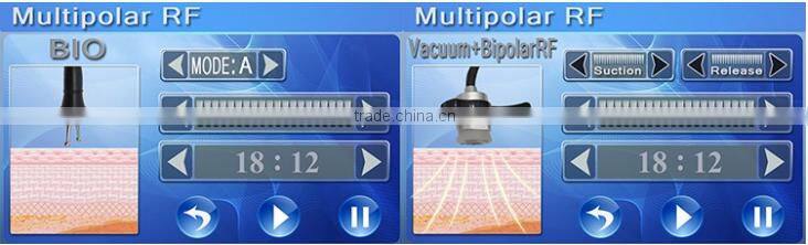 5 in 1 lost weight explosive speed grease cavitation slimming system