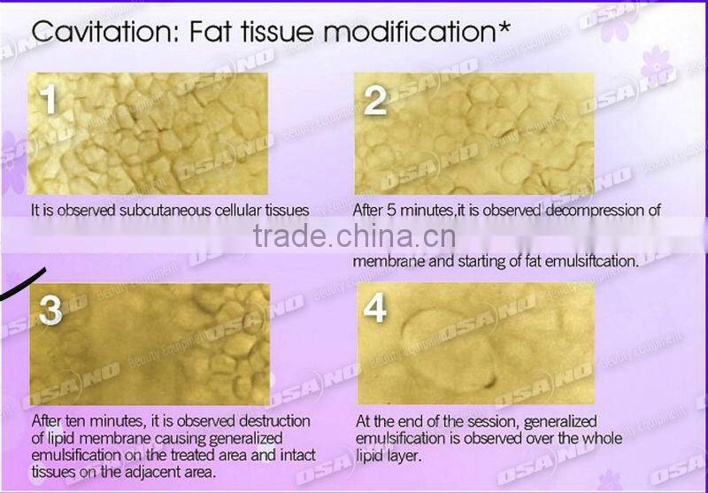 wrinkle removal Beauty weight loss radiofrequency equipment