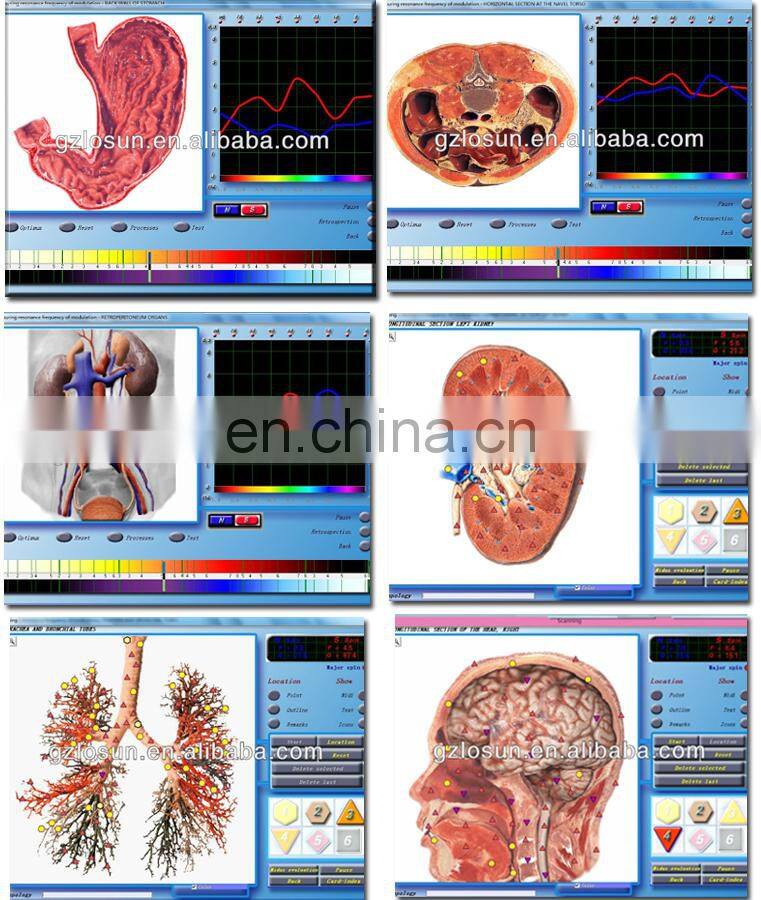 AE Organism Electric 3D NLS Body Health Analyzer Non Linear Diagnostic System