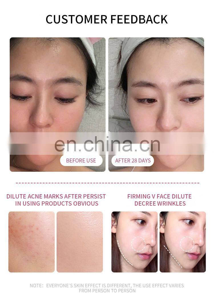 RF Skin Rejuvenation Skin Care Beauty Instrument For Home Anti-aging Lifting and Firming Skin Wrinkles Removal Massage Machine