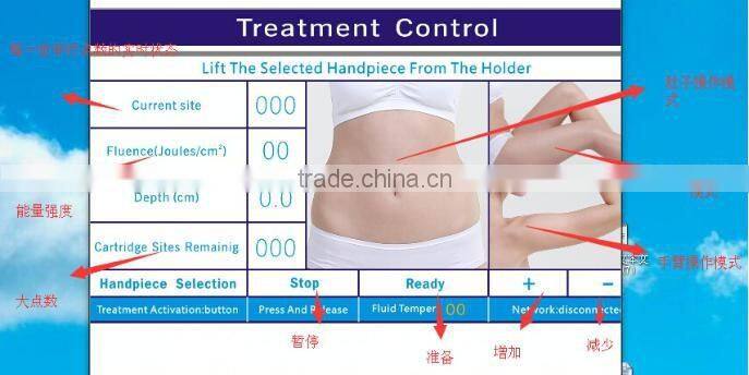 576 points one shot focused ultrasound slimming machine / hifu body slimming machine want distrobutor