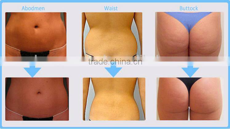 Langdai manufacturer HIFU for body slimming machine effective beauty machine for beauty salon use