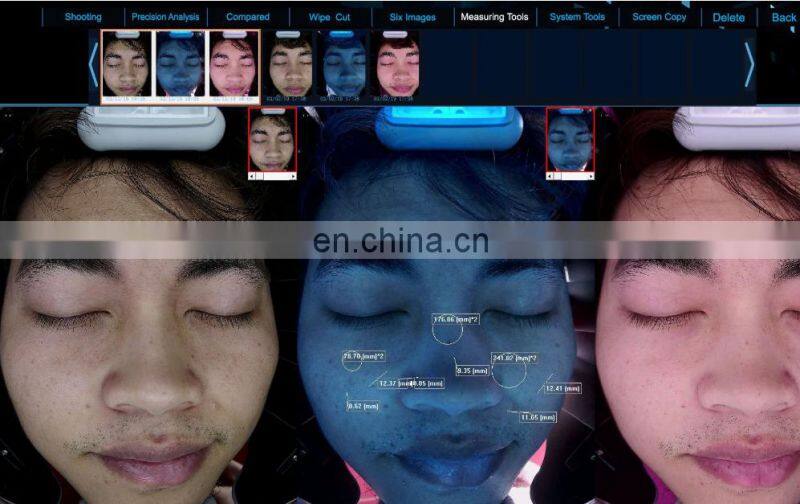 Sales 2022 Hot seal magic mirror facial UV Mositure tester Grease Wrinkle skin analyzer