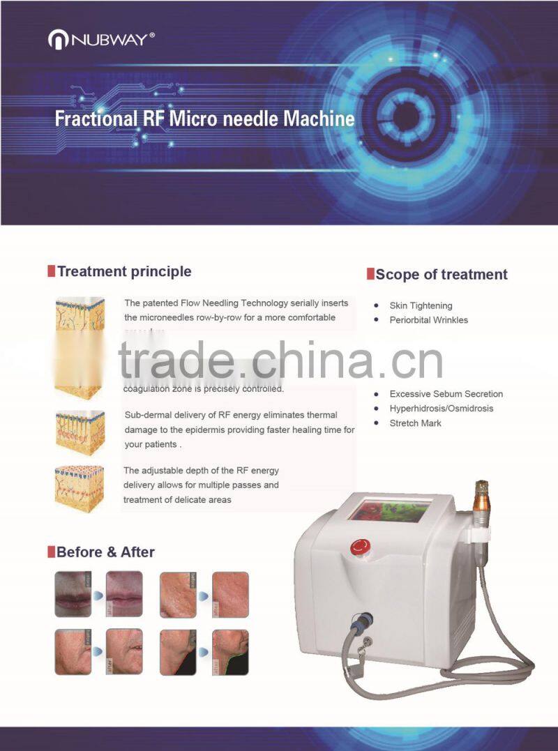 fractional rf face lift machine/microneedle skin rejuvenation microneedle fractional rf machine