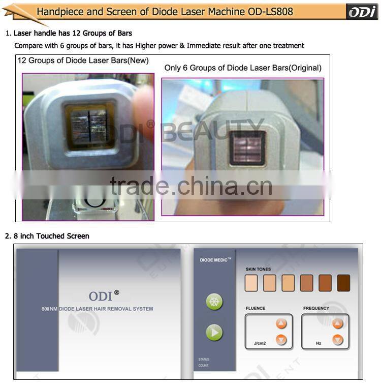 Bestselling cheap laser hair remover diode laser system OD-LS808