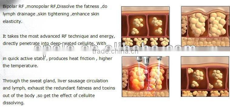 ultrasound therapy machines HS 530RV portable ultrasound therapy machine by shanghai med apolo medical tech