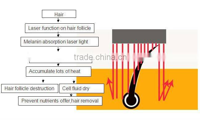 P001 Dark Skin Laser Hair Removal Long Pulse Laser with Two Treatment Heads