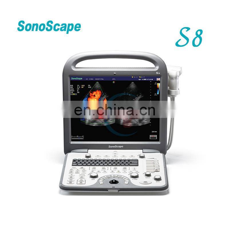 Sonoscape S8 portable color doppler ultrasound scanner sonoscape ultrasound machine S8