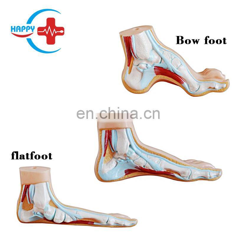 HC-S274 Normal foot/flat foot/arched foot model,Medical Human Anatomical foot model