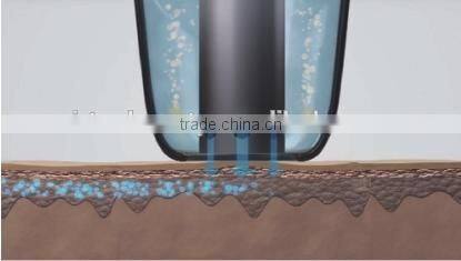 180KPa high power deep hydra dermabrasion peel facial machine /microdermabrasion machine