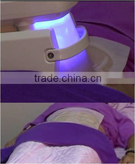 Ciolipolisis Pads Anti Freeze Cryotherapy Antifreeze Membrane to protect skin