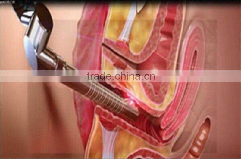 CO2 laser beauty device for vaginal tightening&vaginal nourish with high quality