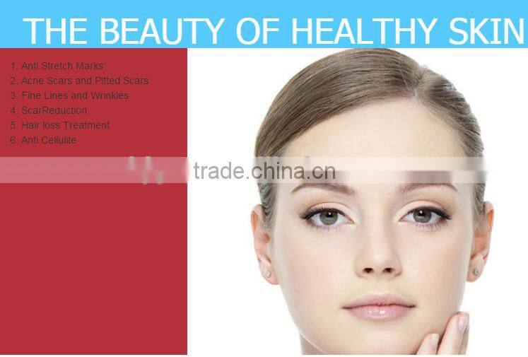 mt derma roller,dns derma roller,derma roller for hair loss treatment