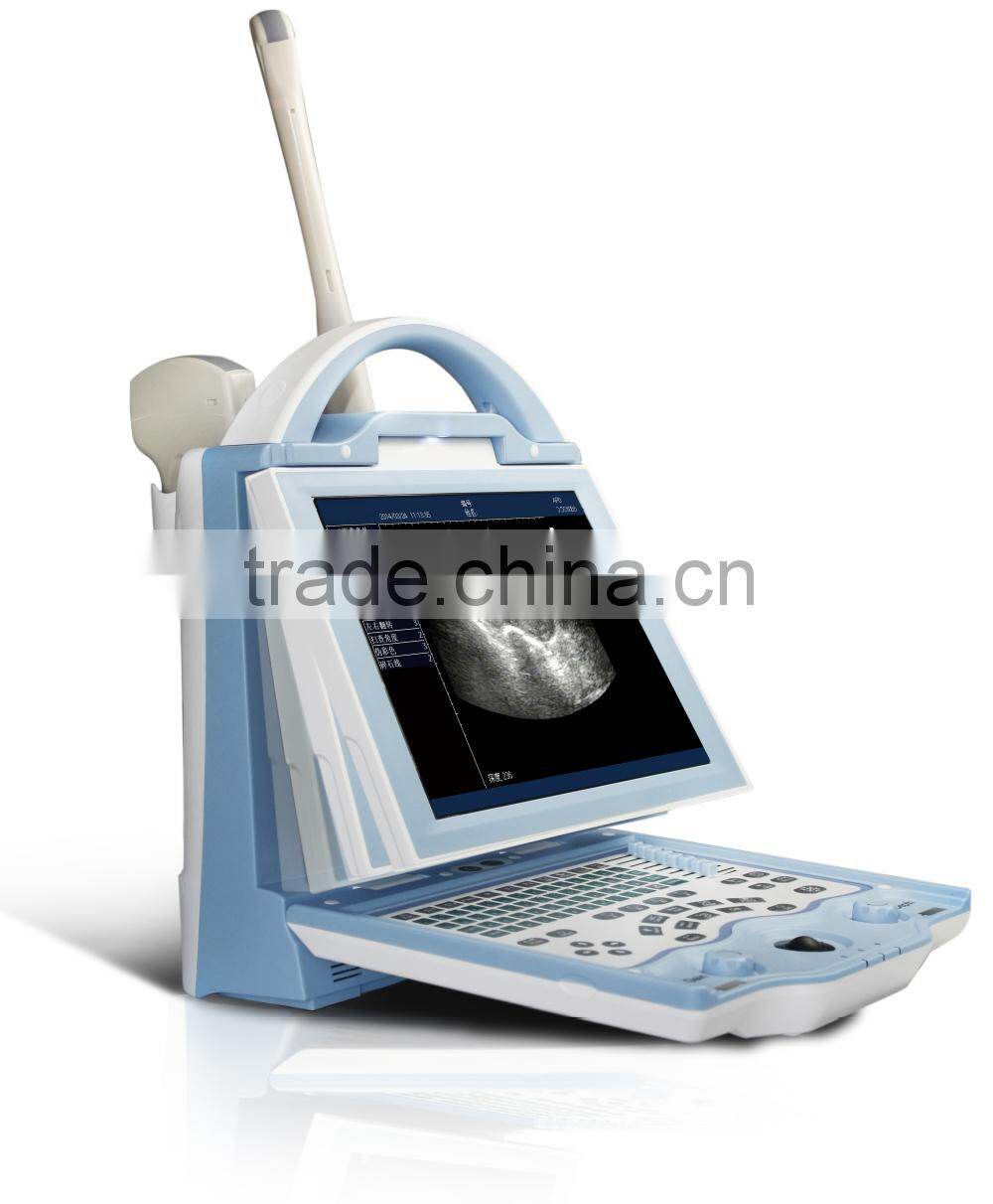 Model:FN560V Pregnancy sheep ultrasound scanner