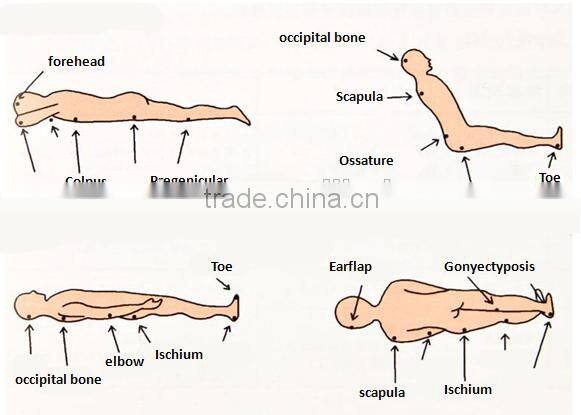 Alternating Pressure Mattress Systems Hospital anti decubitus mattress hospital medical bed air mattress