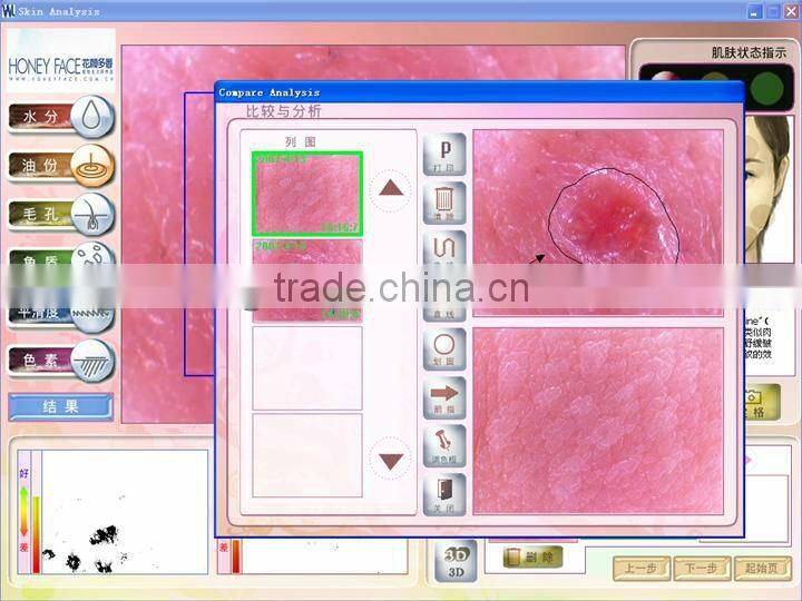 Touch screen auto facial skin scanner analyzer 2013 new beauty machine BD-P006