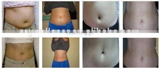 $2850/set in June Promotion Multifunction Cryolipolysis Freezing Fat Machine with 5 Handpiece For Salon / Clinic use