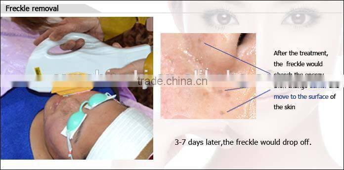Durable portable IPL SHR OPT for permanent hair removal beauty machine