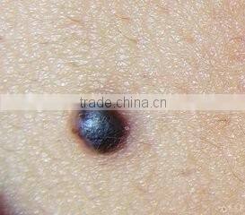 Micro Portable Handhold freckles removal pen