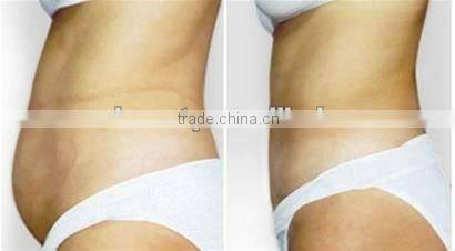 Stable energy Painless treatment slimming machine F019