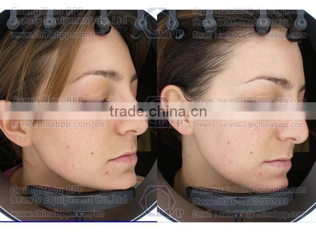 2015 Hot uv light facial skin analysis machine for speckles analysis