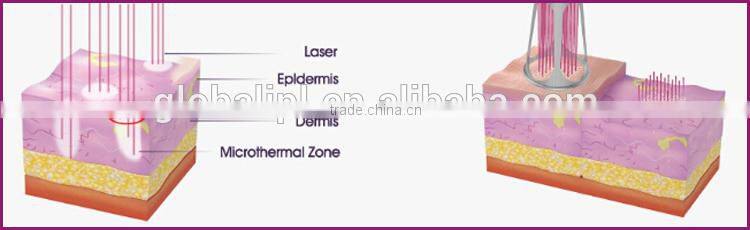 Laser Beauty machine best price pigment remover vagina tightening machine
